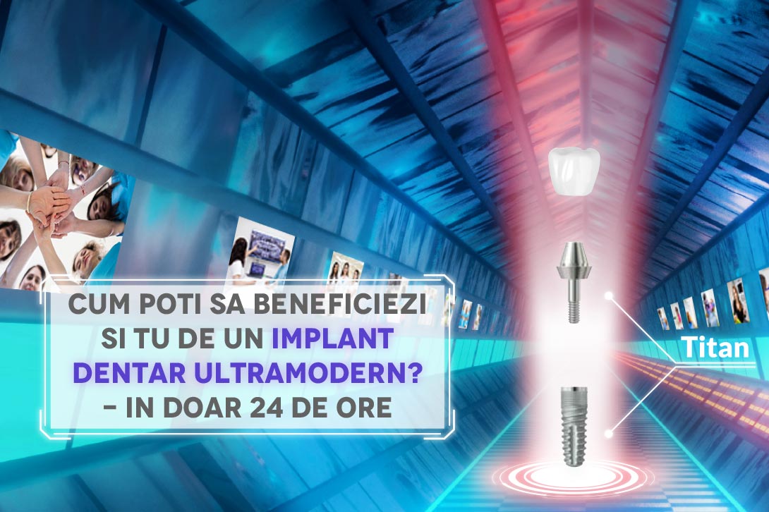 Implant dentar