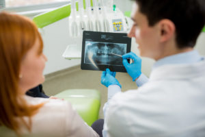 Dinti extrasi – complicatii inlocuire| Dental Excellence