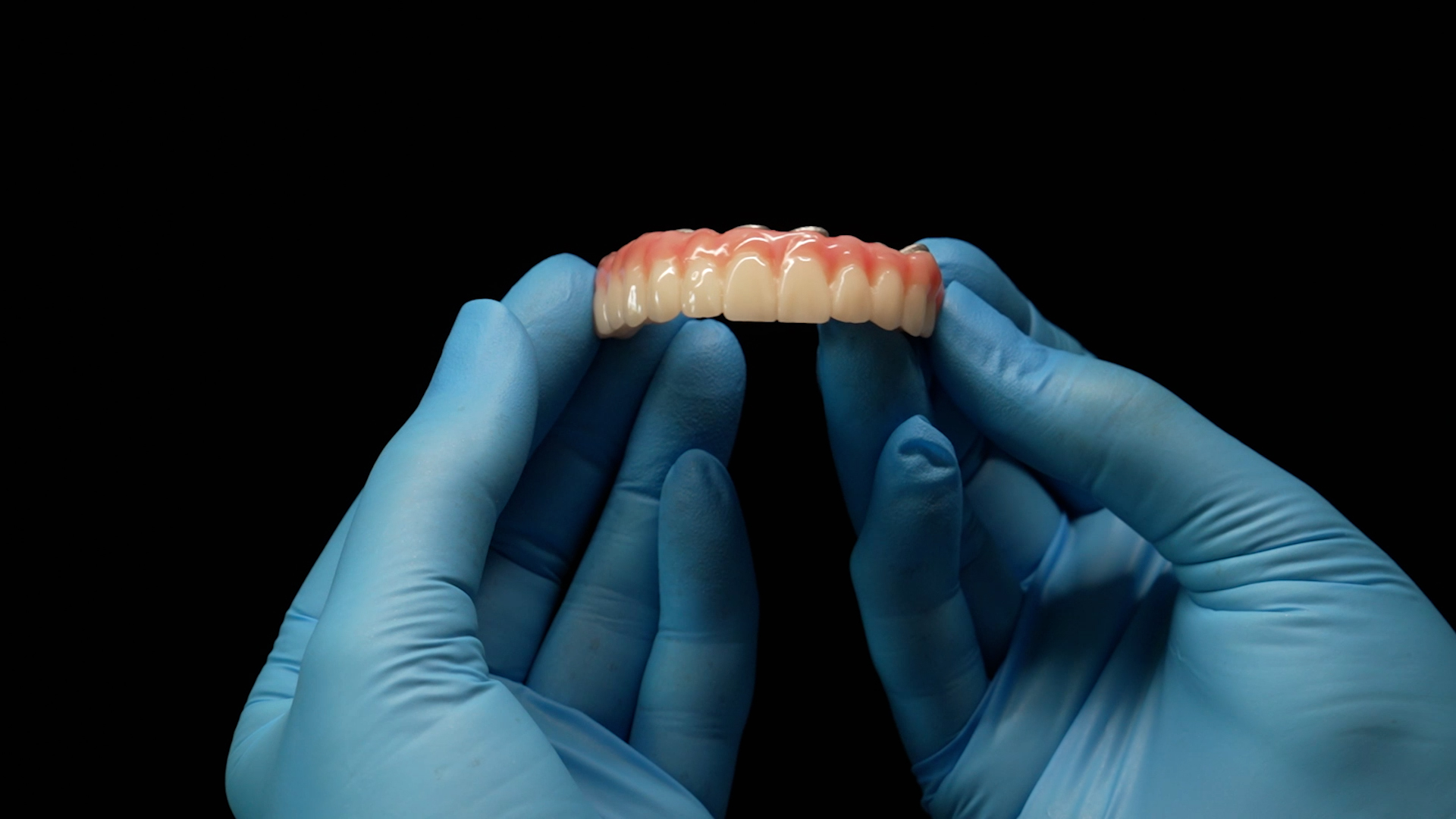 Dantura-fixa-Dental-Excellence